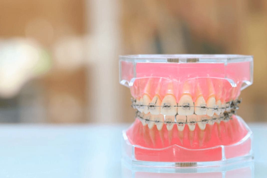 デーモンシステム