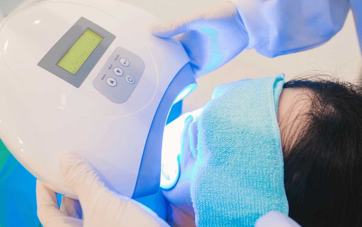 ホワイトニング