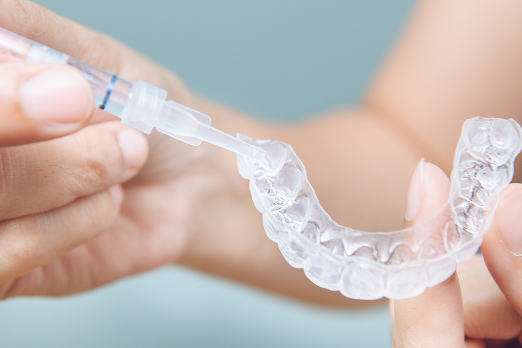 ホームホワイトニング（ご自宅での施術）